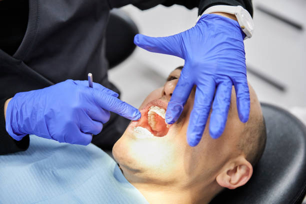 Best Emergency Tooth Extraction  in Merryville, LA